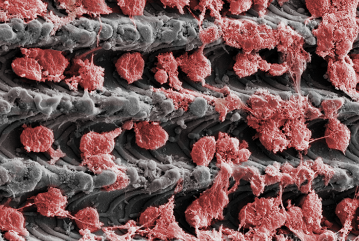 Laser-Lok microchannels