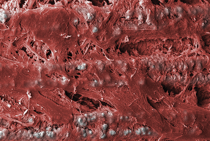 Laser-Lok microchannels